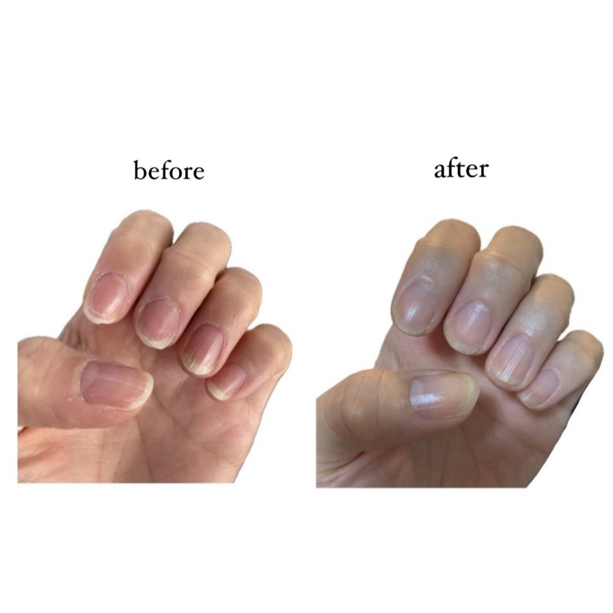 手元の乾燥対策